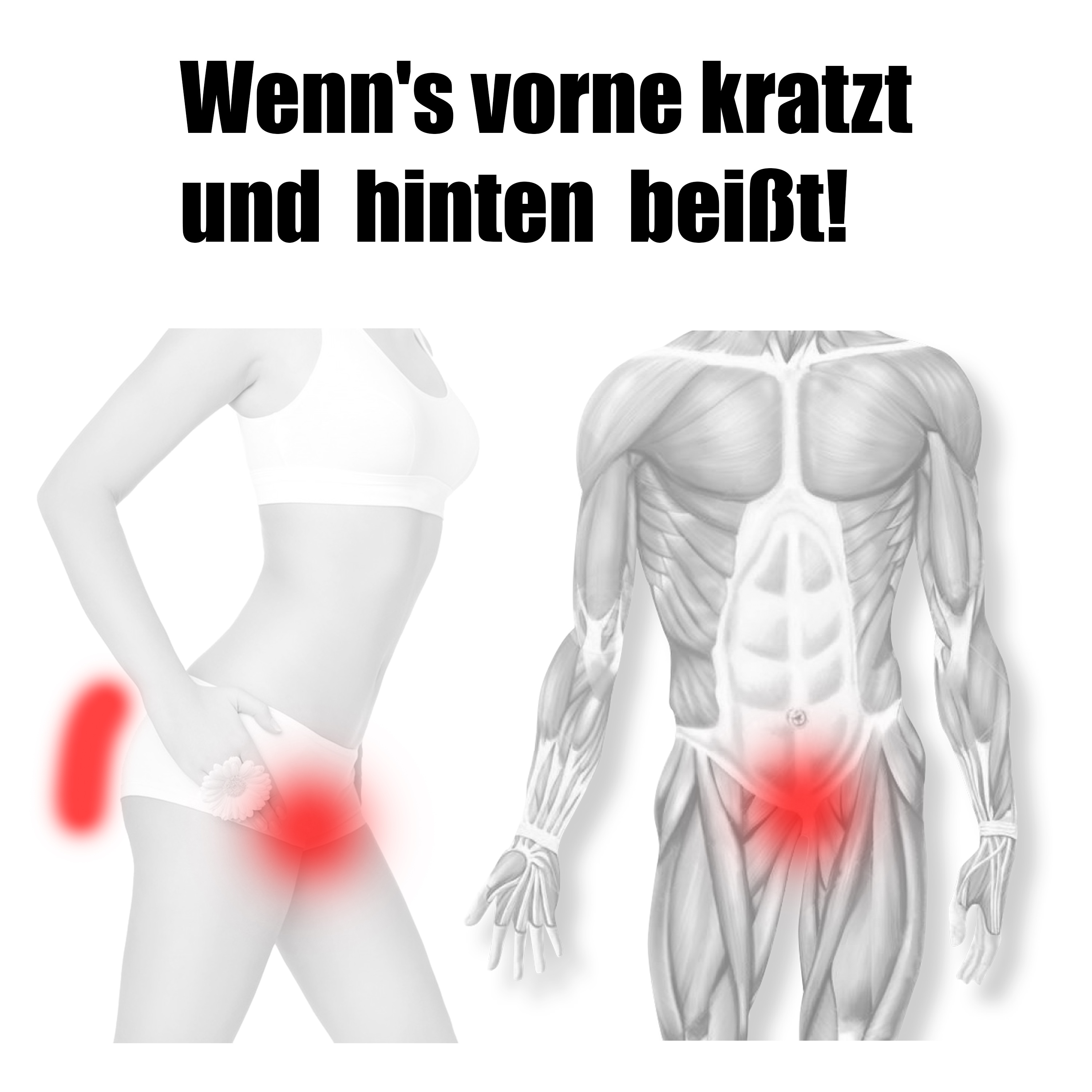 Wenn's vorne kratzt und hinten beißt! artwork
