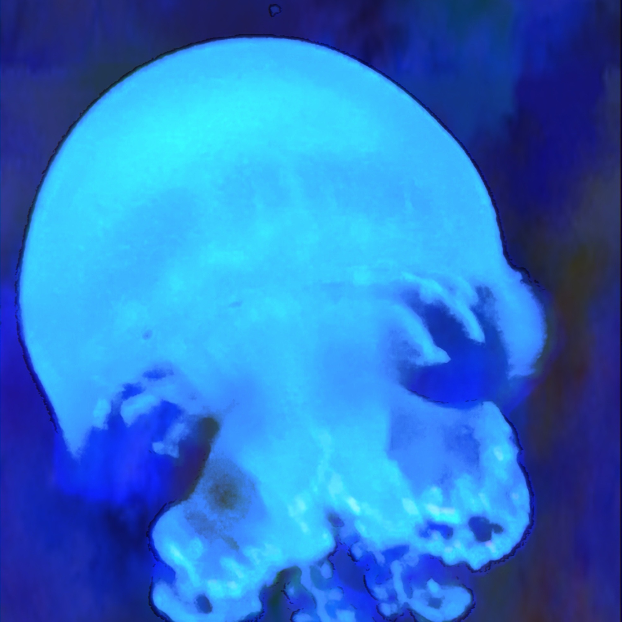 XDeville