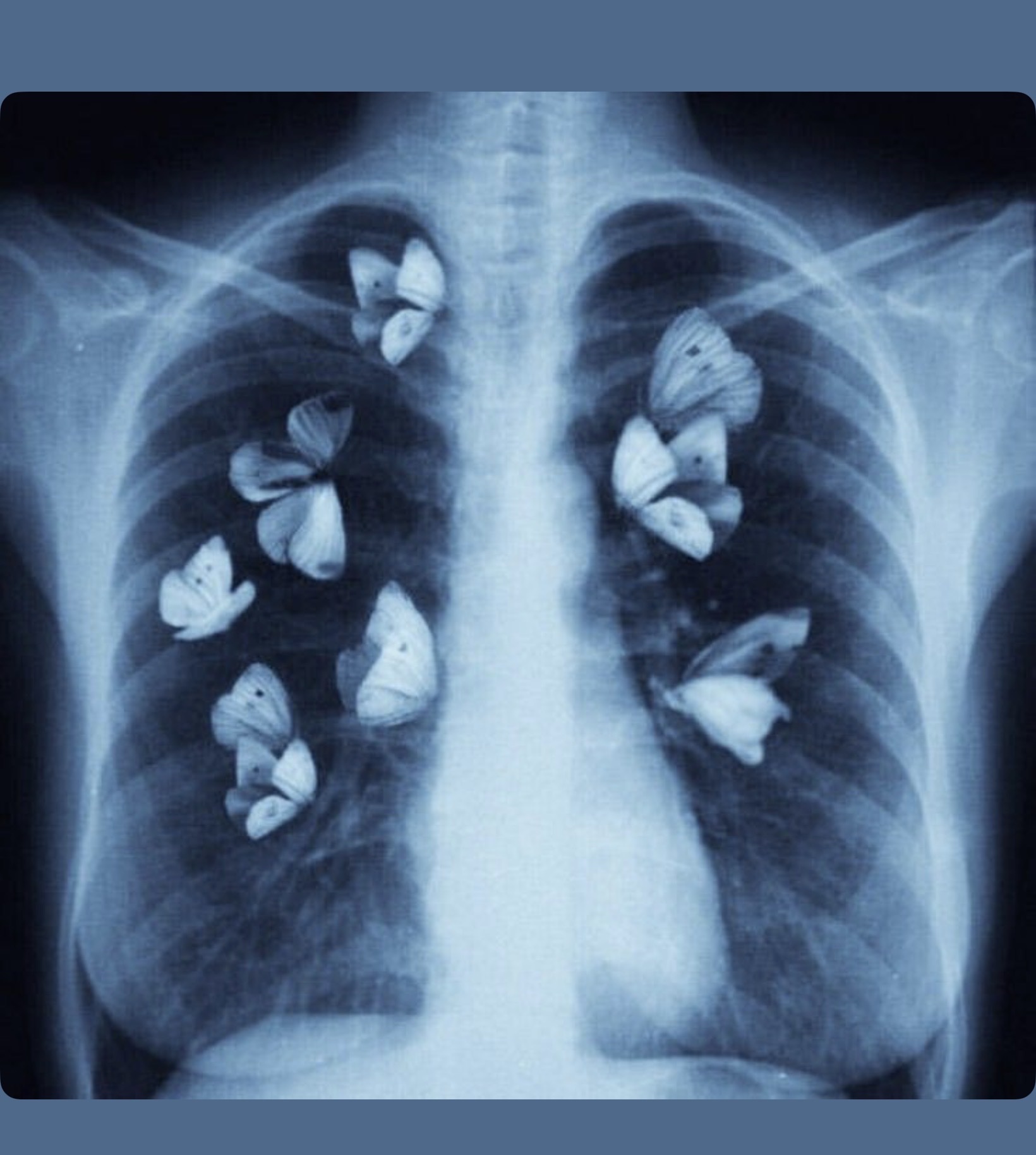 Butterflies in My Lungs v.2 artwork