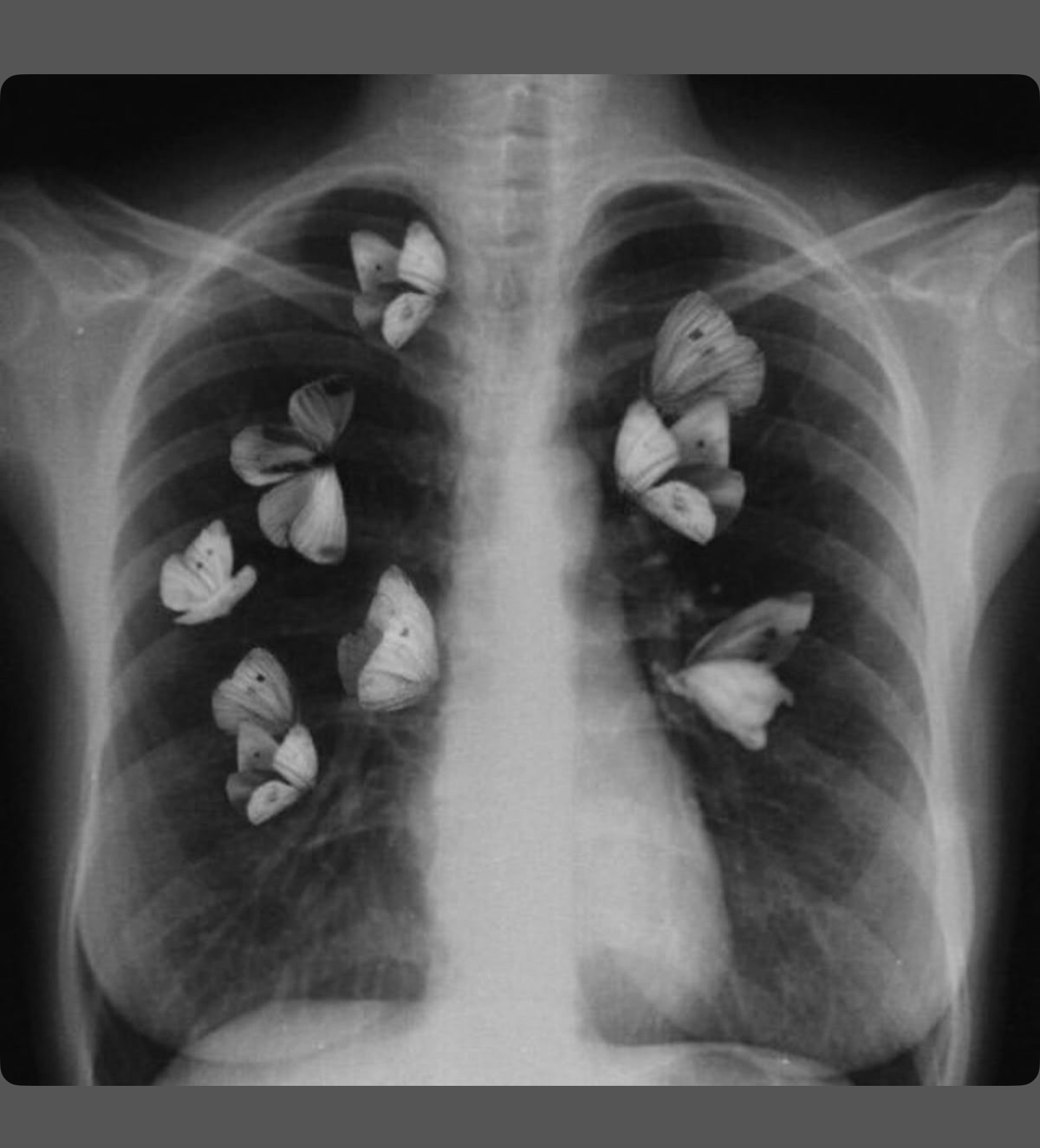 Butterflies in My Lungs artwork