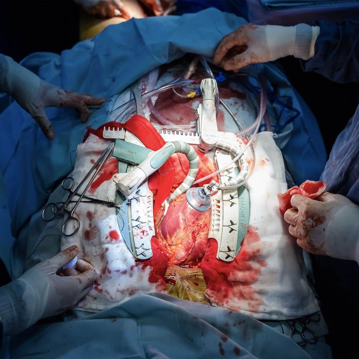 Image for Hurt Songs