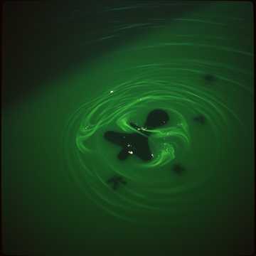 LEPTOSPIROSIS (THE SICKNESS WITHIN)