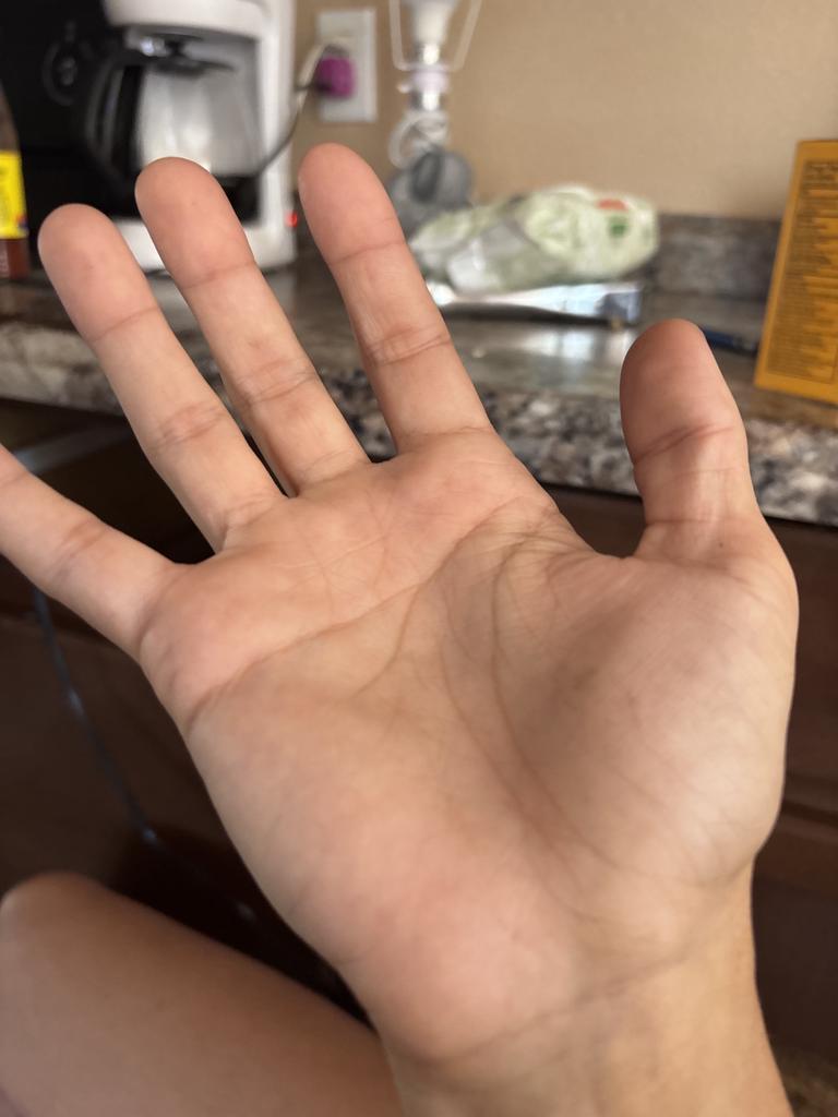 Mismatched Yellow Socks artwork