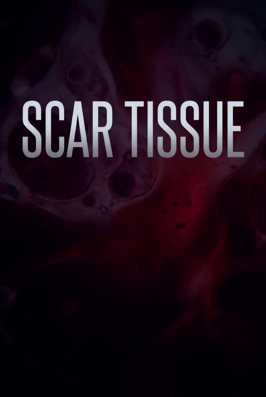 Scar Tissue artwork