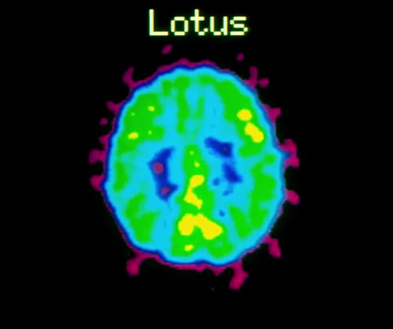 Lotus artwork